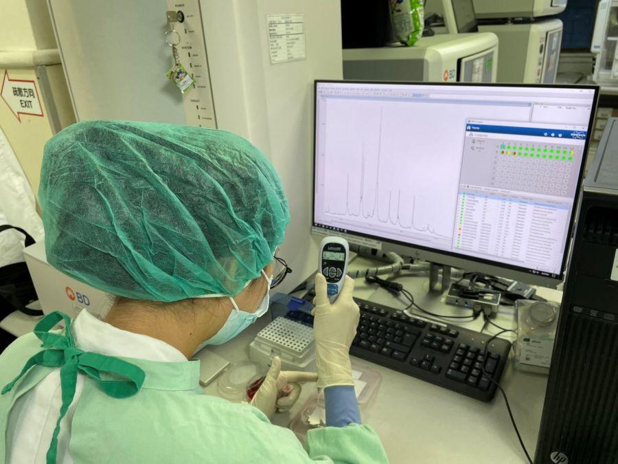 抗藥性 03.質譜儀檢測樣品的製備。(照片提供/中醫大附醫微生物組)